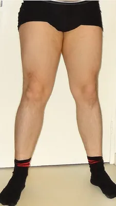 Third-party reference photograph used as the before position